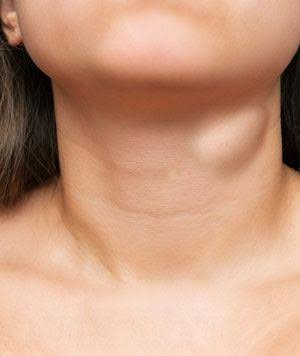 HEAD, NECK AND BODY